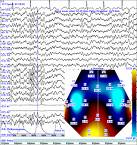 Brain Waves